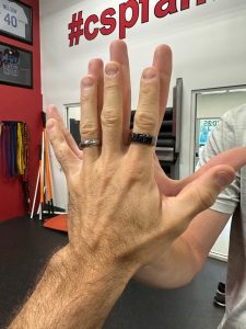 Hand Size, Anatomy, and Tissue Extensibility